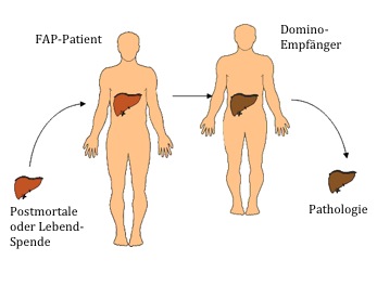 Abb.1 Konzept der Domino-Lebertransplantation (adaptiert nach www.fapwtr.org)