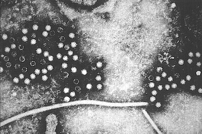 Virionen des Hepatitis-E-Virus