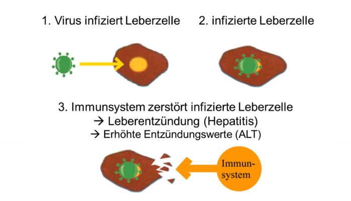 Hepatitis E übertragung Mensch Zu Mensch Hepatitis-B / -D Infektionskrankheiten Die Leber