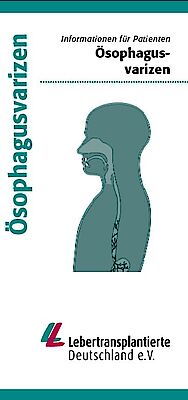 Oesophagusvarizen